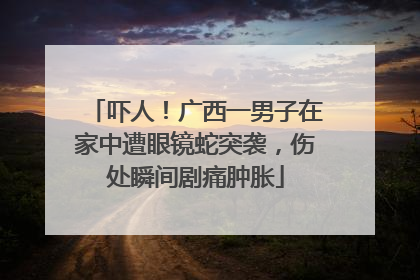 吓人！广西一男子在家中遭眼镜蛇突袭，伤处瞬间剧痛肿胀